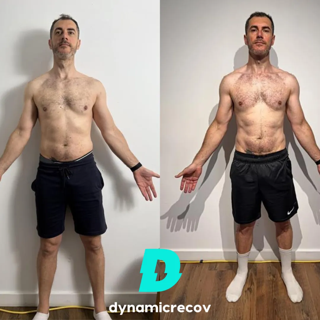 Dynamicrecov Campsie