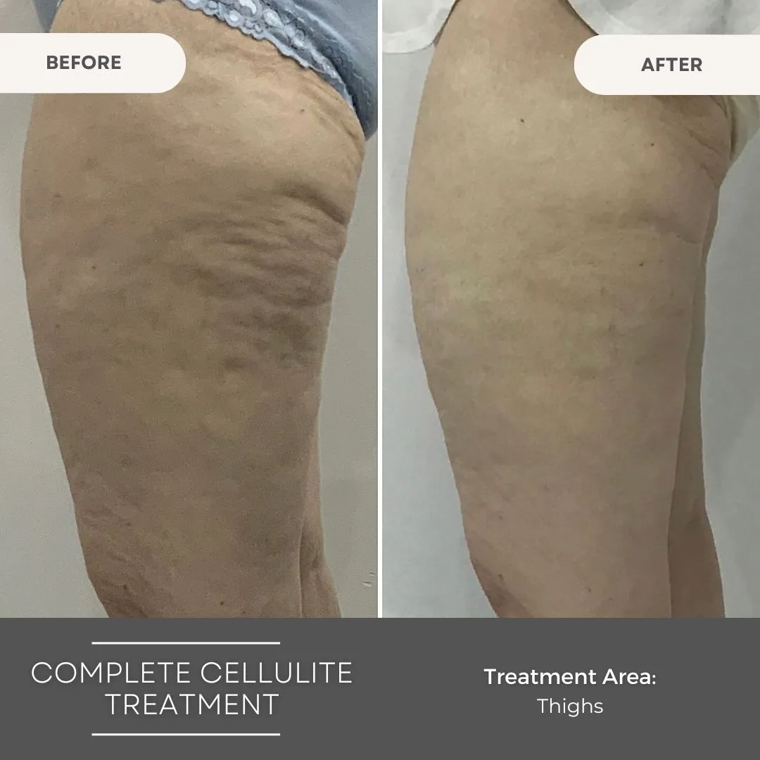 Body Sculpting Clinics Bondi Junction