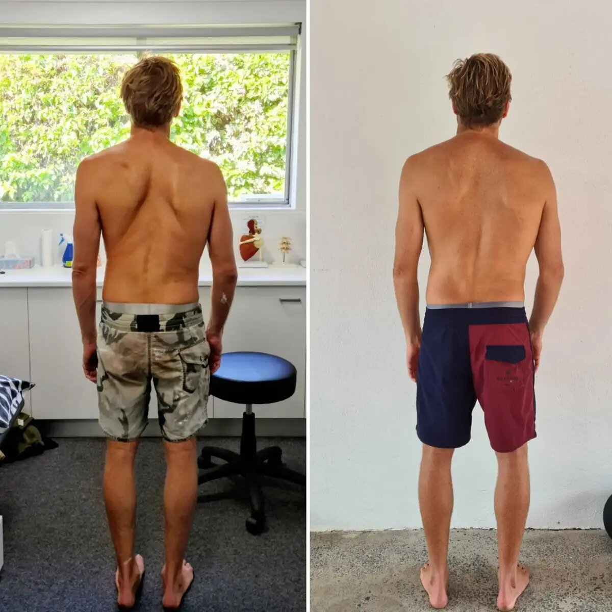 Functional Patterns Sunsine Coast