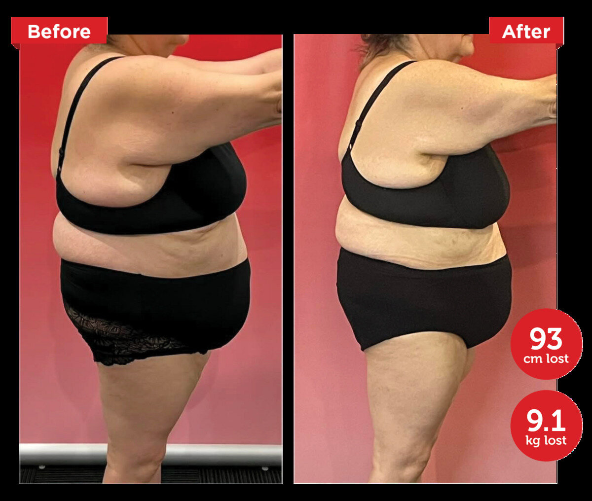 Hypoxi Springfield (not in use)